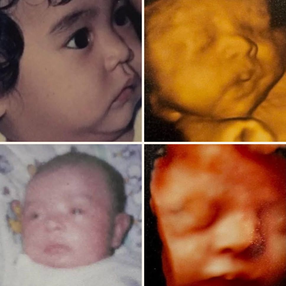 Two family baby photos beside Baby E’s 3D ultrasound at 30 weeks